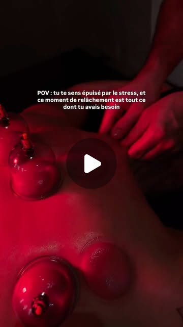 Cupping en séance détente — Résilience Concept